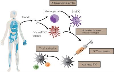 Dendritic cell vaccine of gliomas: challenges from bench to bed